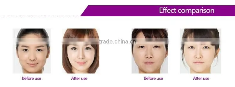 Portable Mesotherapy Needle Free Skin Rejuvenation Electrophoresis Facial Skin Photon Lights Machine