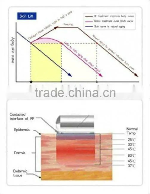 VY-M2A Home use ultrasonic vacuum cavitation machines for body slimming