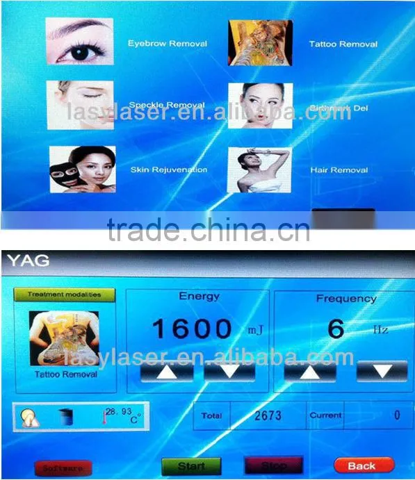 laser q-switch nd yag laser pigmentation removal machine for all pigment removal