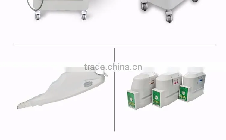 2016Fashion smartsonic hifu ultrasound for skin lifting
