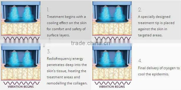 Best rf skin tightening face lifting machine&newest skin lifting machine