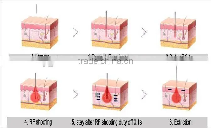 The best selling microneedle fractional RF machine professional for skin tighten RF machine