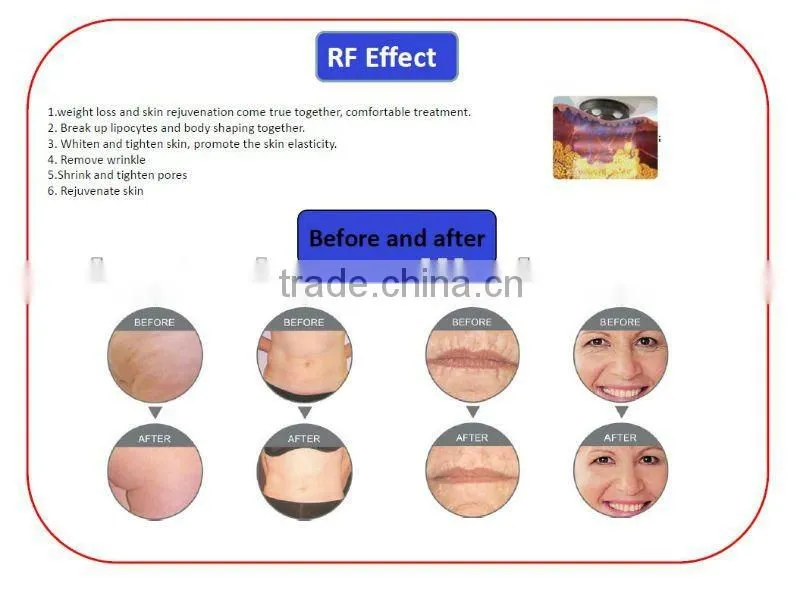 CE approval ultra sound cavitation slim for sale