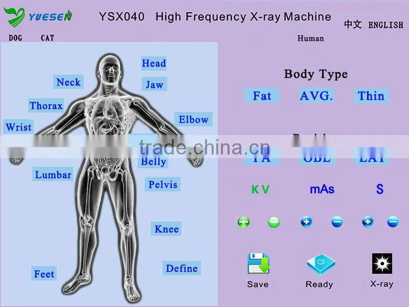 low price high frequency mobile portable 4kw popular x ray machine