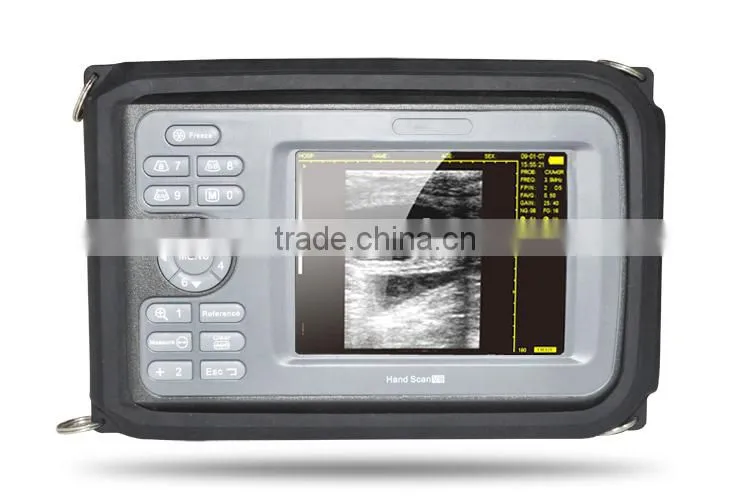 Handheld Digital PalmSmart Veterinary/VET Use Ultrasonic Scanner with Convex Probe-V8