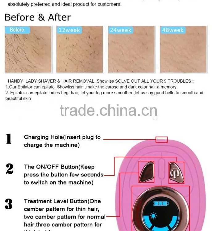 Hot selling hair removal machine personal use skin care removal hair machine