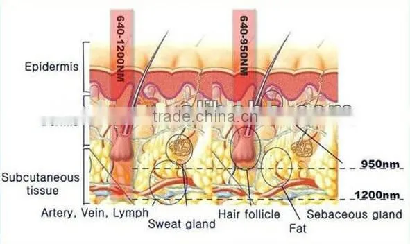 2015 Laser IPL SHR Lumea IPL Hair Removal System CE/ISO