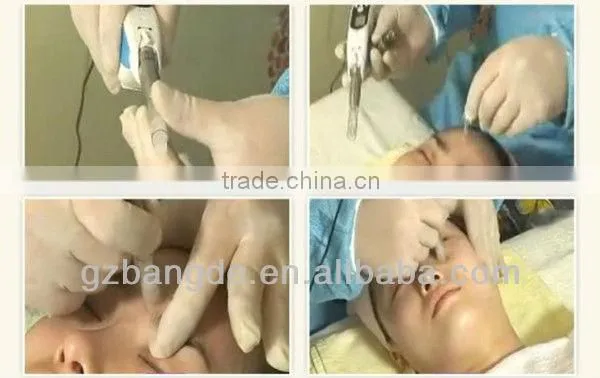 Handheld electric microneedle in derma rolling system BD-WZ001