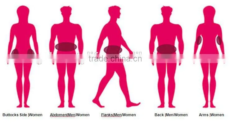 Freezing fat cryolipolysis machine non-surgical cellulite reduction home liposuction machine