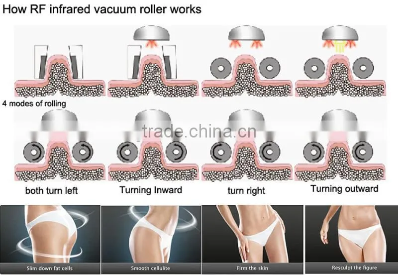 Lingmei Body Slimming--Fast Safe Way to Reduce Fat!!! V10 RF Cavitation Auto Roller Vacuum Dermo Vacuum Massage