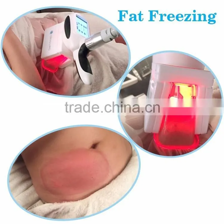 -15 to 5 Degree cryolipolisis fat frozen slimming cool lipo venus freeze machine