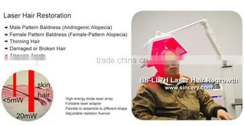 New Invention Alibaba Hair Loss Treatment Machine