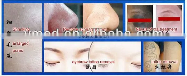 2016 Medical Aesthetic Equipment Tattoo Removal Machine