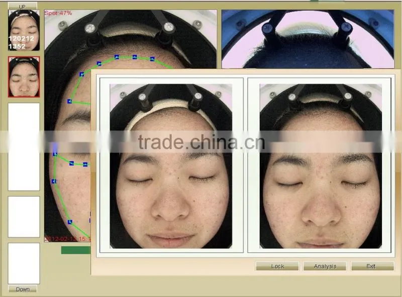 skin analyzer magnifier machine skin analysis system