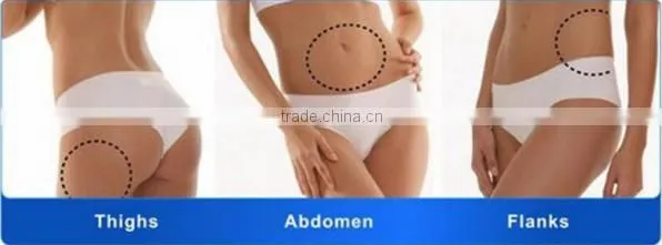 Permanent Body Slimming Ultrashape/Best slimming machine Ultrashape/High Quality Ultrashap machine for salon