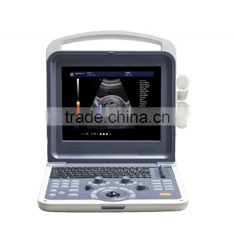 Digital Color Doppler 4D Ultrasound Machine K6