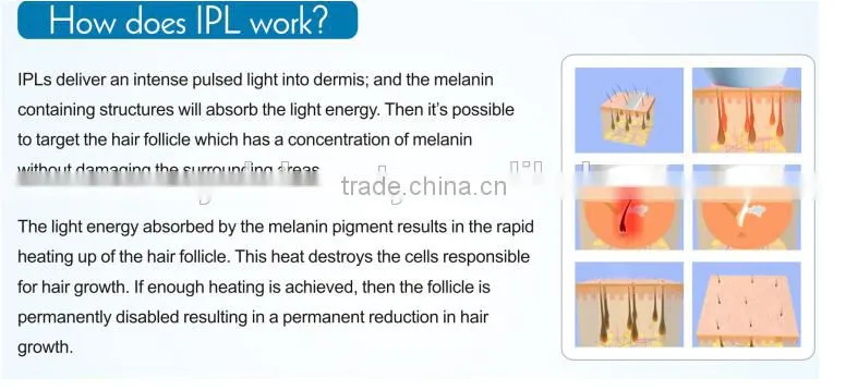 2016 YALO Hair Removal Machine for woman use