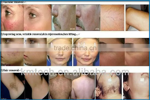 Multifunctional beauty machine made in china