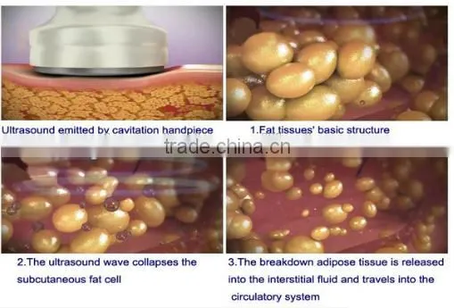 CE Certification portable Laser+Cavitation+RF+Vacuum cavitation slimming machine