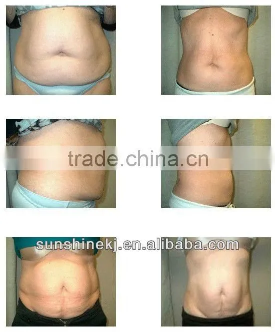 2016 Hot 5 treatment handles ultrasonic cavitation weight loss machine