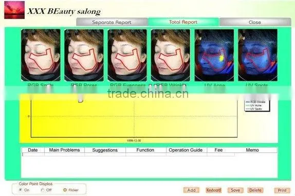 VY-M01 Magic skin and hair analysis machine