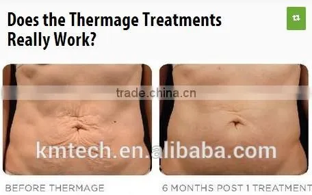 No surgery KM face lift machine for sagging skin treatment with CE ISO TUV BV SGS