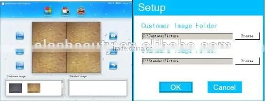 ELOS 3S 3 in 1 Skin Analyzer