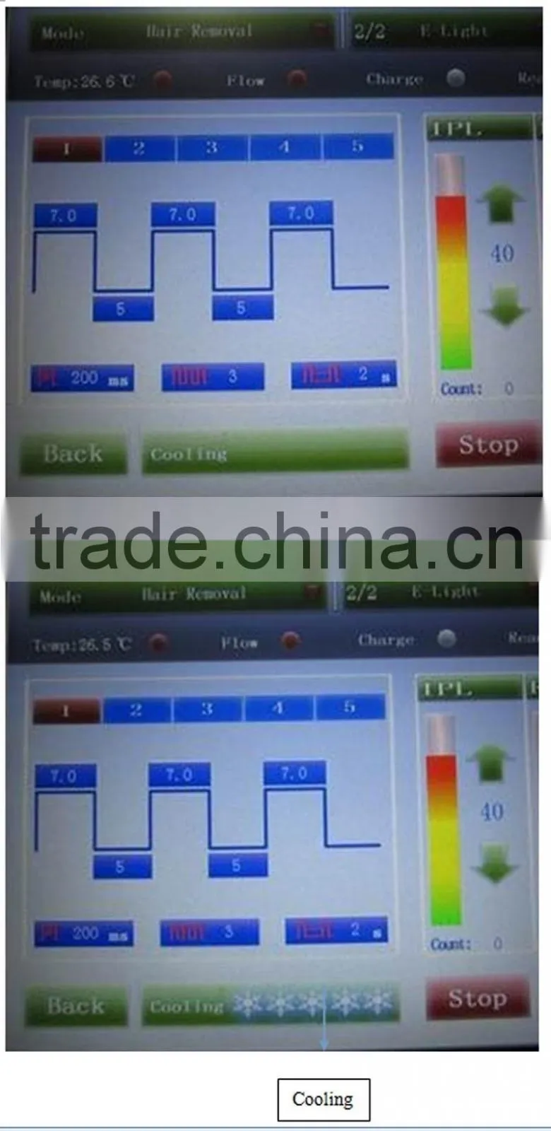 E-LIGHT Treatment High Quality Laser Tattoo Removal Machine
