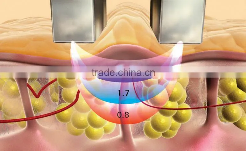 Professional Reaction Face Shaping Radio Frequency Anti-wrinkle RF machine