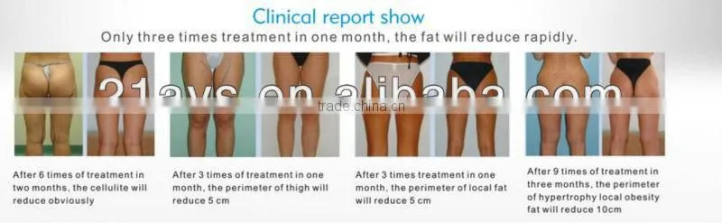 Cryolipolysis Slimming Storm beauty equipment