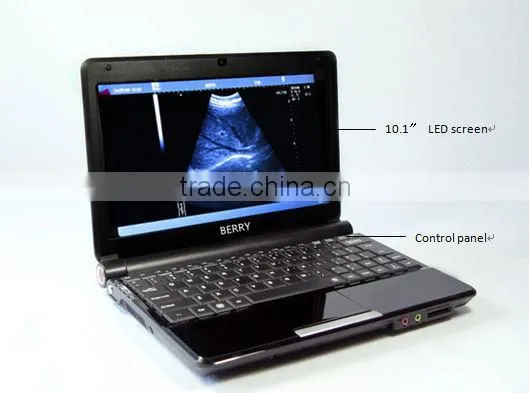 Health&Medical Equipment B/W Portable Ultrasound scanner