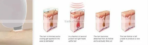 Best quality handheld hair removal laser portable/hair removing laser home