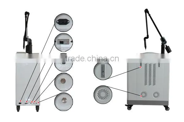2016 high quality factory price q switch nd yag laser tattoo removal equipment