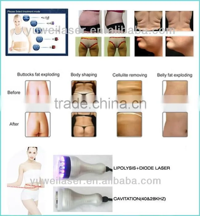 Hot sale 7 in on multifunctional ultrasound cavitation&RF machine /Cavitation RF machine/body slimming