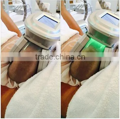 Cryo Cryolipolysis Cooling System Weight Loss Machine / Cryolipolysis Fat Reduction Machine
