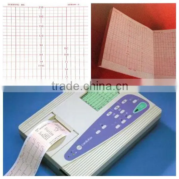 Fetal Monitor Paper / 110mm*100mm-150p Fetal Monitor Recording Paper for Analogic Scientific ASF-030