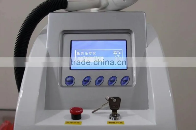 2016 Cheapest protable Q-switch ND yag home use laser / nd yag laser tattoo removal