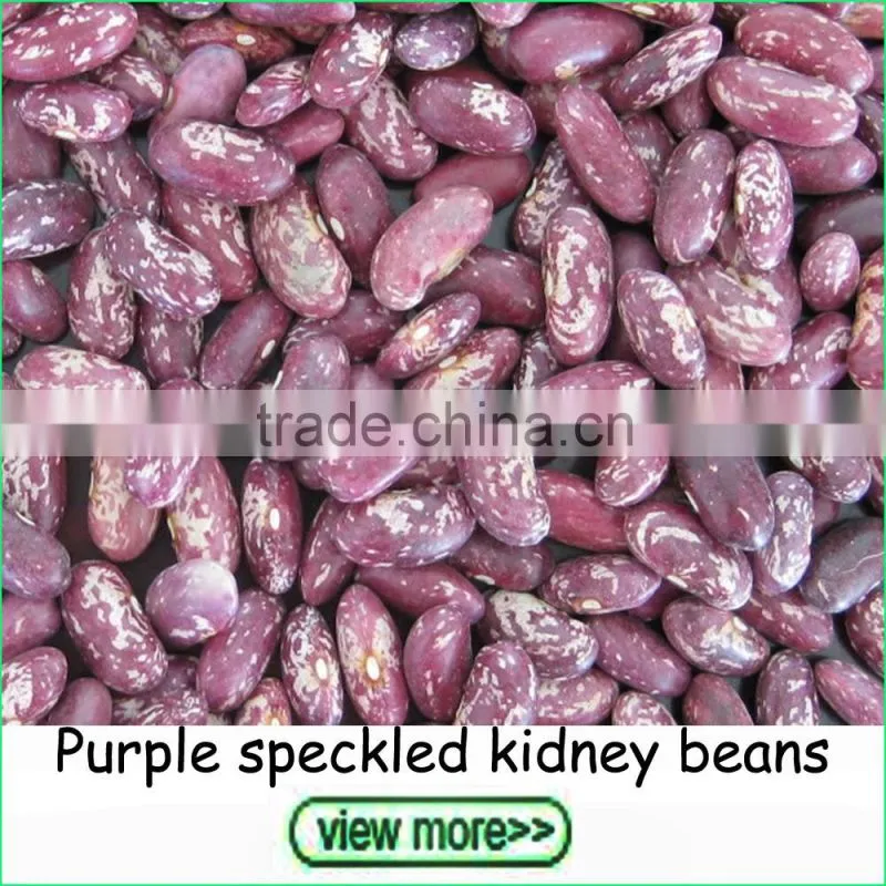 2016 Crop small size white kidney beans navy beans