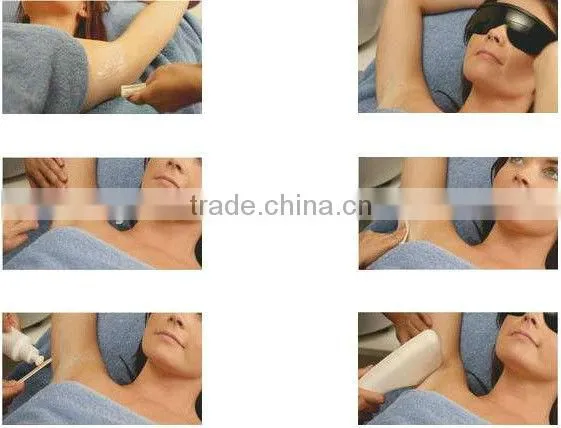 Multifunctional Beauty machine elight ipl hair removal/rf wrinkle removal/laser tattoo removal medical machine