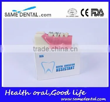 Right Tooth Tissue Decomposition Model Dental Eduction Assitant No. DEA-17