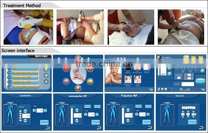 Hot selling CE TUV 6 handles portable elight mini ipl laser for age spots