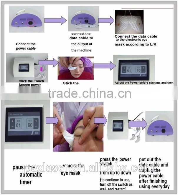 Eye Wrinkle Treatment RF eye lift machine