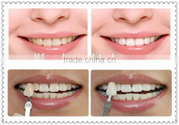 Excellent teeth bleaching system