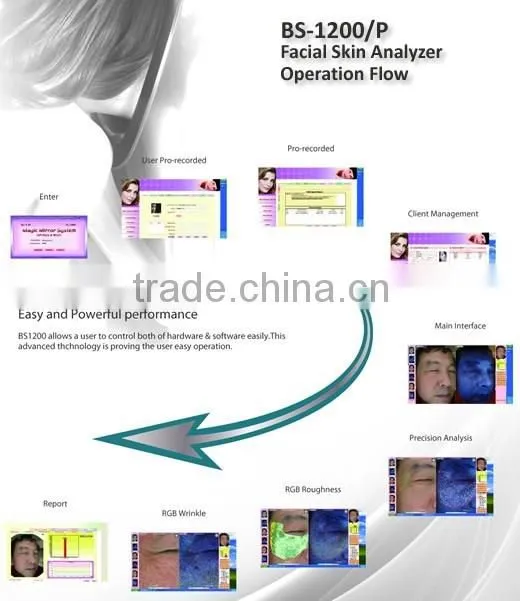 Body slimming equipment tracking treatment machine 3D skin analyzer