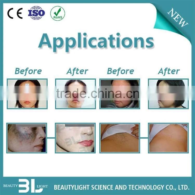 E-light+RF+Lazer beauty equiment with CE