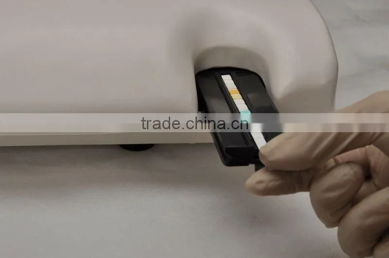 Semi-automated Urine Analysis