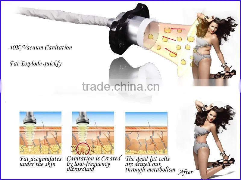 Professional Multifunctional Fat freeze Body Slimming fat loss Machine Cryo Lipo+Cativation+Bipolar RF with Cooling Plate