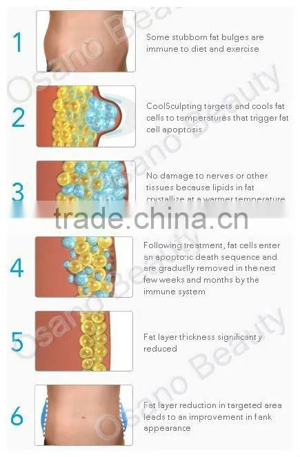 Portable Cryolipolyse Equipment Fat Freeze Machine Cryo Liposuction