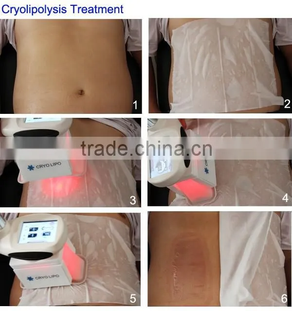 Fat Freezing Criolipolisis Lipocavitation Machine multifunction machine aesthetics