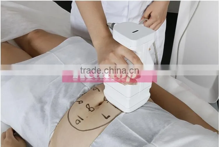 Professional ultrasounic hifu body shape machine ultrashape liposonic hifu slimming machine on sale
